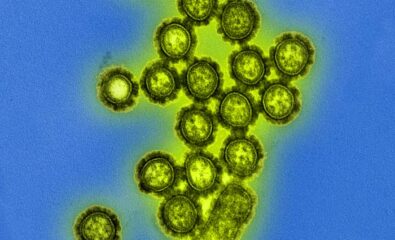 Electron Microscopic View of H1N1 Influenza Virus Particles. Digitally colorized transmission electron microscopic view of H1N1 influenza virus particles.