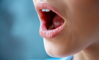 Bacterial Infections of the Oral Mucosa