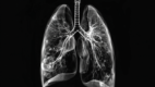 Human lungs