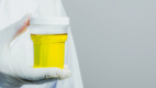 Urine sample