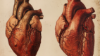 Normal Heart next to an enlarged heart