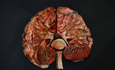 Human brain cross section