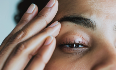Woman with Dry Eye Syndrome