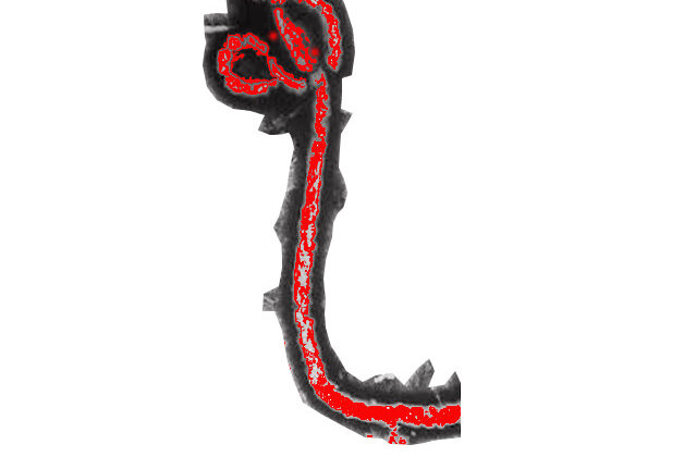Ebola Virus