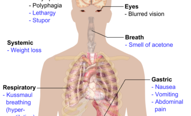 Overview of the most significant possible symptoms of diabetes