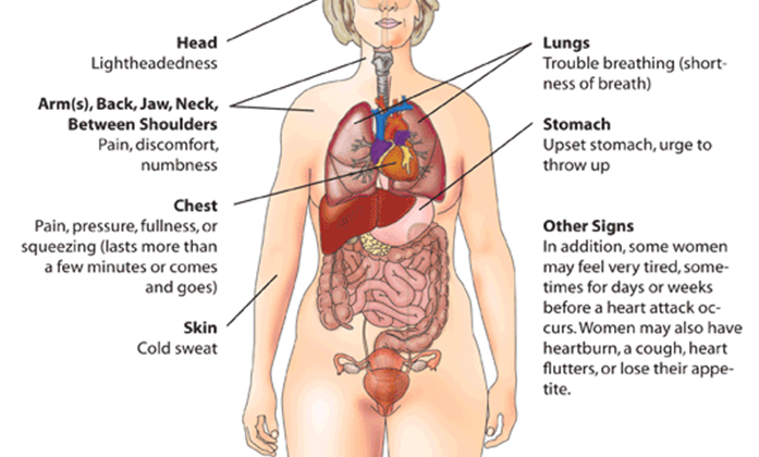 Myocardial Infarction (Heart Attack) Warning Signs in Women.