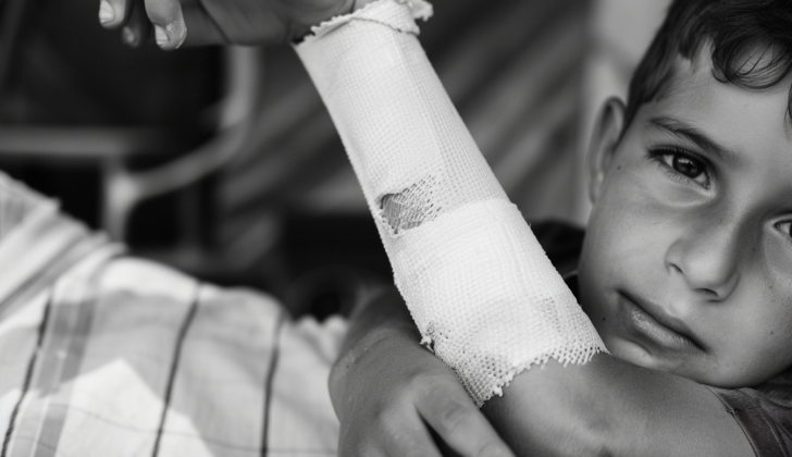 Child with a nightstick fracture