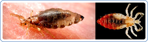 Body Lice