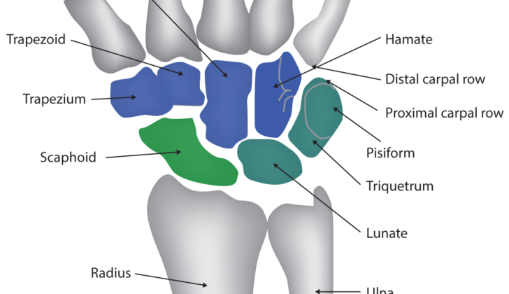 Wrist Joint Anatomy. Anatomy includes capitate, trapezoid, trapezium, scaphoid, radius, hamate, distal carpal row, proximal carpal row, pisiform, triquetrum, lunate, and ulna.
