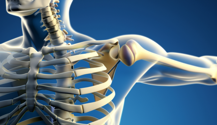 Diagram of shoulder dislocated from socket