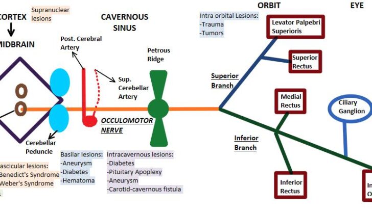 Oculomotor Nerve