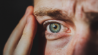 Man with redness, eye pain from Epithelial Downgrowth