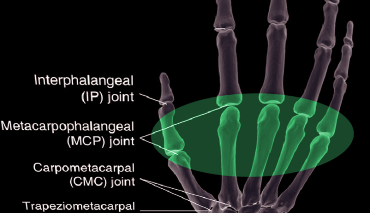 Metacarpal joint