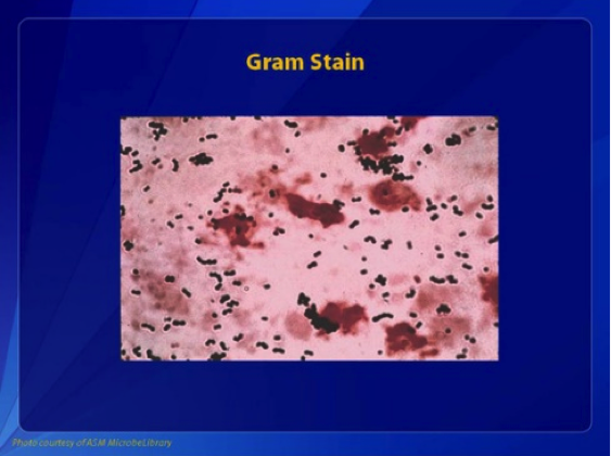 Group B Streptococcus, Gram Stain. This Gram stain of group B streptococcus shows gram-positive cocci in pairs and chains.