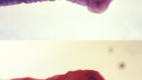 Scolex of the Taenia Saginata and Taenia Solium, Pork Tapeworm (top) and Beef Tapeworm (bottom)