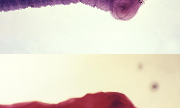 Scolex of the Taenia Saginata and Taenia Solium, Pork Tapeworm (top) and Beef Tapeworm (bottom)