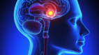 Location of pituitary gland