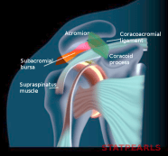 Subdeltoid Bursitis 1089x1024 Subdeltoid Bursitis 1089x1024