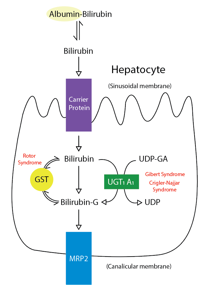 Metabolic Pathway for Bilirubin in the Hepatocyte. Bilirubin-G corresponds to
bilirubin glucuronate; the donor is uridine diphosphate glucuronic acid
(UDP-GA). This is catalyzed by the enzyme uridine
diphosphate-glucuronyltransferase (UGT1A1). Gilbert and Crigler-Najjar syndrome
is associated with decreases in UGT1A1 activity. Glutathione-S-transferase (GST)
is a carrier protein that assists bilirubin uptake into the cytosol and may be
implicated in Rotor syndrome.