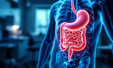 Intestinal Carcinoid Cancer