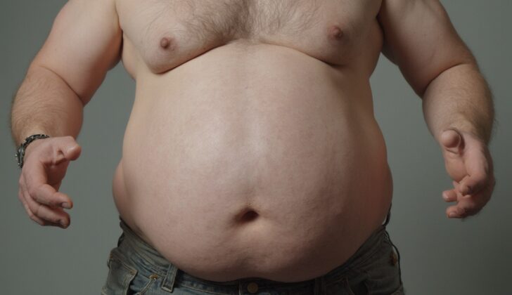 Chronic Liver Disease (Longterm Liver Disease)