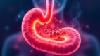 Esophageal Cancer