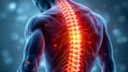 Failed Back Surgery Syndrome