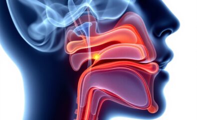 Laryngotracheal Stenosis