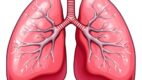 Nonspecific Interstitial Pneumonia