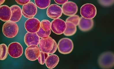 Poikilocytosis of Red Blood Cells (RBC)