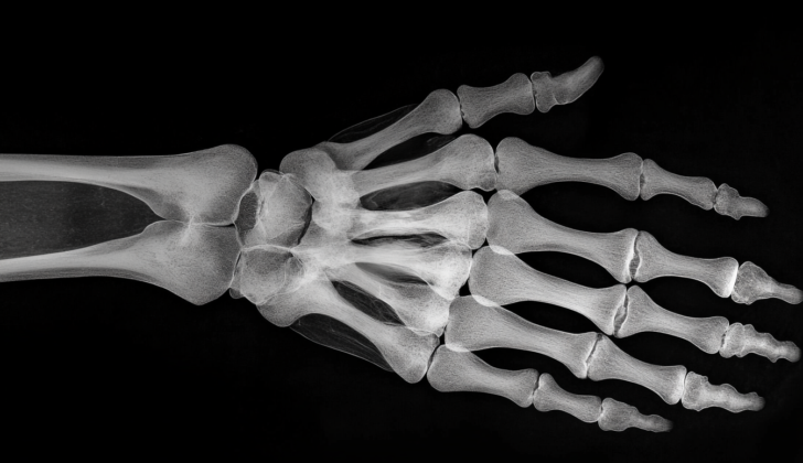 The triangular fibrocartilage complex (TFCC) is a structure in the wrist that provides stability and cushioning between the ulna and the carpal bones.