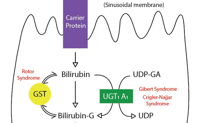 Metabolic Pathway for Bilirubin in the Hepatocyte. Bilirubin-G corresponds to bilirubin glucuronate; the donor is uridine diphosphate glucuronic acid (UDP-GA). This is catalyzed by the enzyme uridine diphosphate-glucuronyltransferase (UGT1A1). Gilbert and Crigler-Najjar syndrome is associated with decreases in UGT1A1 activity. Glutathione-S-transferase (GST) is a carrier protein that assists bilirubin uptake into the cytosol and may be implicated in Rotor syndrome.