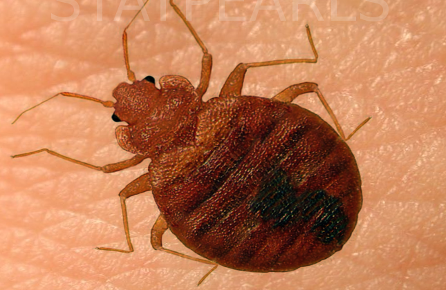 BedBug on skin