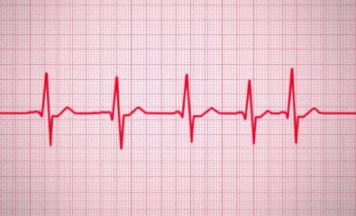 ECG T Wave