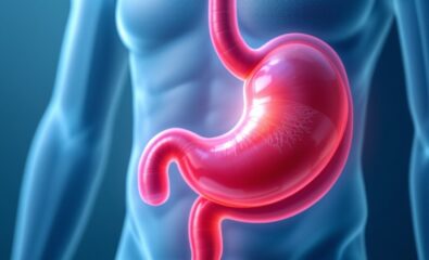 Gastric Outlet Obstruction