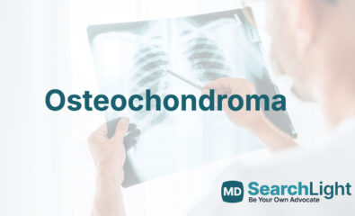Osteochondroma