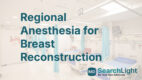 Regional Anesthesia for Breast Reconstruction