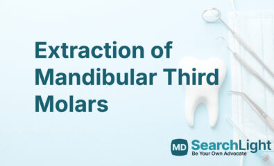 Oral Surgery, Extraction of Mandibular Third Molars