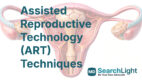 Assisted Reproductive Technology (ART) Techniques