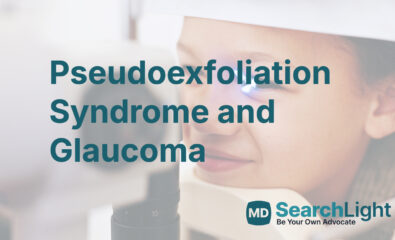 Pseudoexfoliation Syndrome and Glaucoma