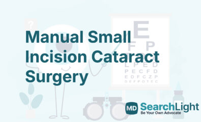 Manual Small Incision Cataract Surgery