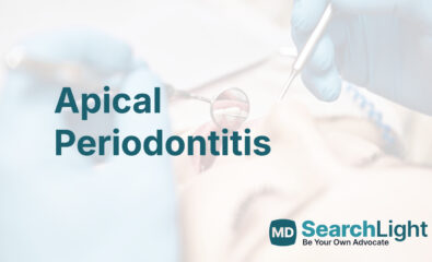Apical Periodontitis