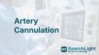 Artery Cannulation
