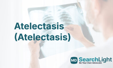 Atelectasis (Atelectasis)