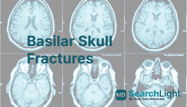 Basilar Skull Fractures