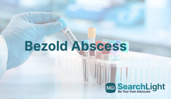 Bezold Abscess