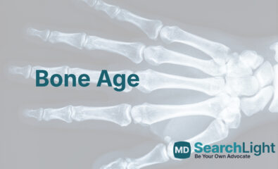 Bone Age
