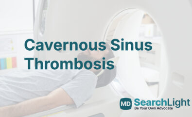 Cavernous Sinus Thrombosis
