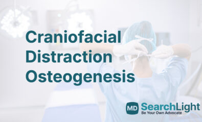 Craniofacial Distraction Osteogenesis