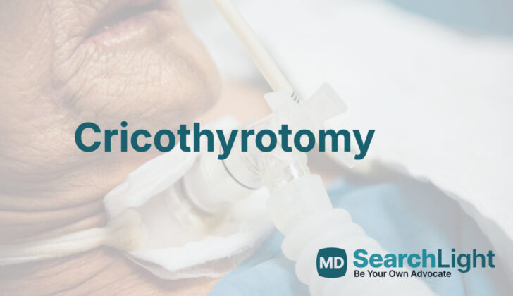 Cricothyrotomy